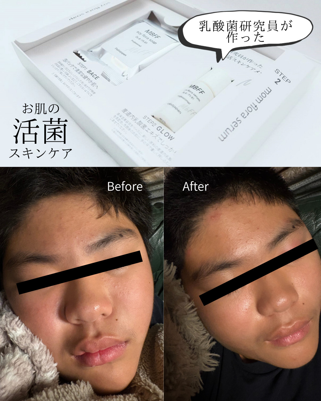 善玉菌 腸活 善玉菌 美肌菌 ニキビ改善 人気スタイリスト　ランキングが高い美容院　白髪染め　ハゲ予防　美革ストレート　岐阜柳津町　ヘアーラウル