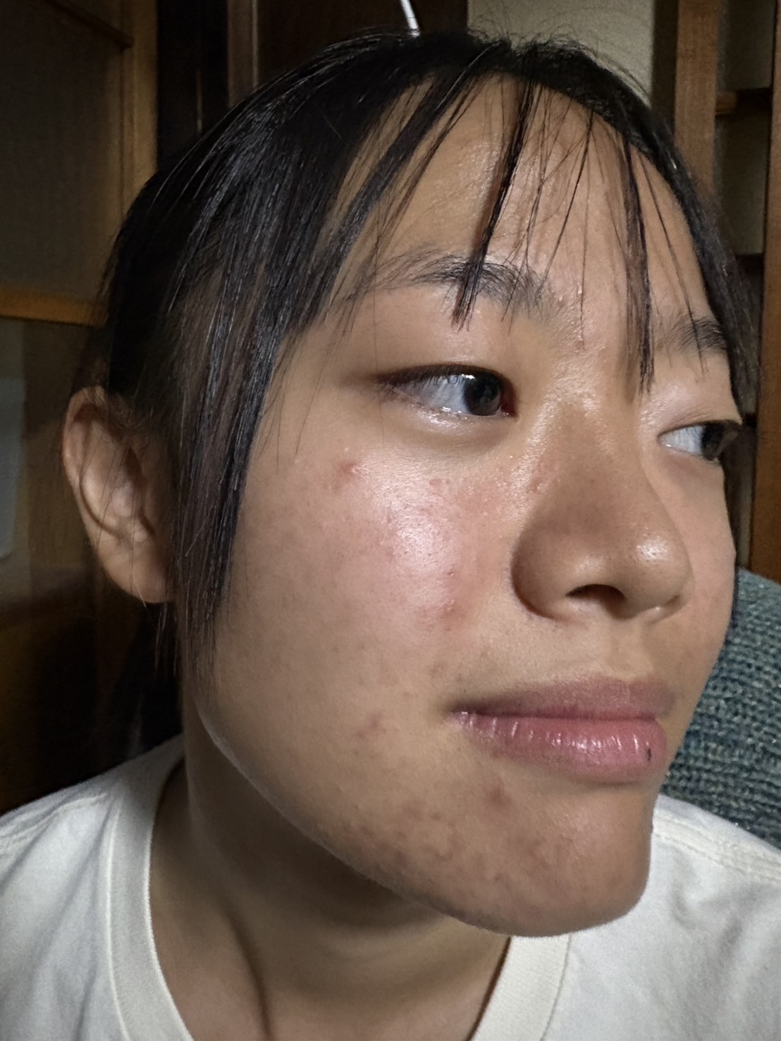 善玉菌 腸活 善玉菌 美肌菌 ニキビ改善 人気スタイリスト　ランキングが高い美容院　白髪染め　ハゲ予防　美革ストレート　岐阜柳津町　ヘアーラウル