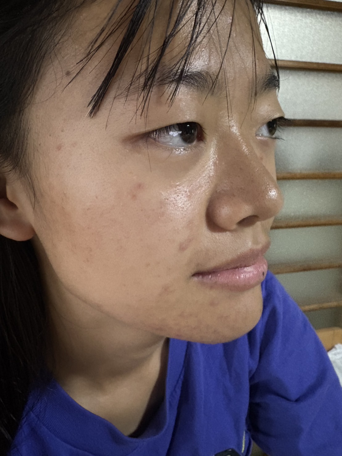 善玉菌 腸活 善玉菌 美肌菌 ニキビ改善 人気スタイリスト　ランキングが高い美容院　白髪染め　ハゲ予防　美革ストレート　岐阜柳津町　ヘアーラウル
